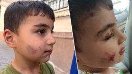 Ankara'da dehşet verici olay! Evde uyuyan çocuğu lağım faresi ısırdı