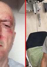 Boşanma aşamasındaki adamın başına gelmeyen kalmadı: &Ouml;nce evinden atıldı sonra burnu kırıldı!