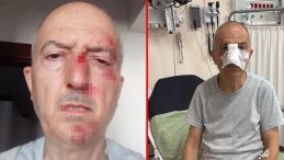 Boşanma aşamasındaki adamın başına gelmeyen kalmadı: Önce evinden atıldı sonra burnu kırıldı!