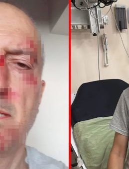 Boşanma aşamasındaki adamın başına gelmeyen kalmadı: Önce evinden atıldı sonra burnu kırıldı!
