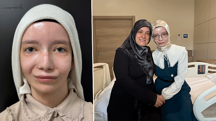Doğuştan Kullanamıyordu, 23 Yıl Sonra Kavuştu: Ülkemizde Bir İlk Olma Özelliği Taşıyor