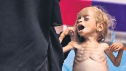 DÜNYANIN GAZZE UTANCI! İSRAİL ÇOCUK DEMEDEN KATLEDİYOR, İNSANLIK SEYREDİYOR