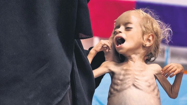 DÜNYANIN GAZZE UTANCI! İSRAİL ÇOCUK DEMEDEN KATLEDİYOR, İNSANLIK SEYREDİYOR