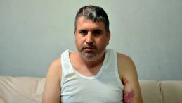 Kadına Miras Yok Dedi, Yeğenini Beyzbol Sopasıyla &Ouml;ld&uuml;resiye Darp Etti