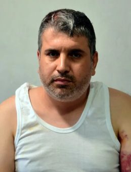 Kadına Miras Yok Dedi, Yeğenini Beyzbol Sopasıyla Öldüresiye Darp Etti