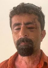 &Ouml;fkeli Damat, Kayınpederini Hastanelik Etti