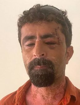 Öfkeli Damat, Kayınpederini Hastanelik Etti
