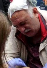 Pazarda Alışveriş Yapan Vatandaşın &Uuml;zerine Demir Direk D&uuml;şt&uuml;