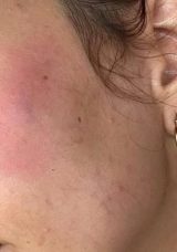 Sokak K&ouml;peğini Besleyen Aile, Komşuları Tarafından Saldırıya Uğradı