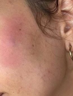Sokak Köpeğini Besleyen Aile, Komşuları Tarafından Saldırıya Uğradı