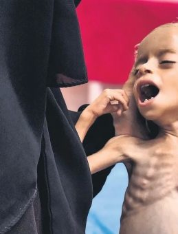 SON DAKİKA | Gazze'deki facia: İsrail, çocuklara dahi acımadan öldürüyor, dünya sessiz kalıyor