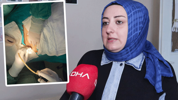 Suştangazi'deki Özel Hastanede Skandal! Karnında Dren Hortumu Unutuldu…