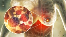 Uzun S&uuml;re Oturanlar Dikkat! Uzmanlardan Uyarı: "Bu Kadınlarda Meme Kanseri Riski Artıyor&hellip;&rdquo;