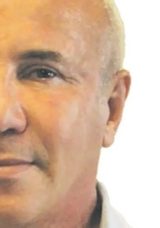Estetik Y&uuml;z&uuml;nden Hayatı Alt &Uuml;st Oldu
