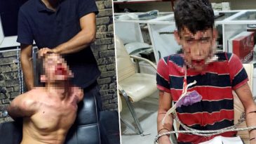 3 G&uuml;n Boyunca İşkence: 'Sabaha Kadar Maruz Kaldım'!