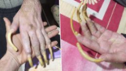 3 Yıldır Dışarı Çıkmıyor! Depremden Sonra Bu Hale Geldi | Sadece Telefonla Oynuyor: "Elimde Olsa Tuvalete de Gitmem, Yemek de Yemem"