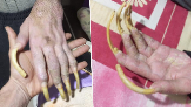 3 Yıldır Dışarı Çıkmıyor! Depremden Sonra Bu Hale Geldi | Sadece Telefonla Oynuyor: "Elimde Olsa Tuvalete de Gitmem, Yemek de Yemem"