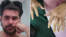 3 Yıldır Evden Çıkmayan Barış'ın Değişimi Ortaya Çıktı