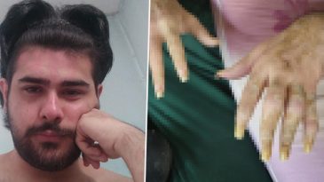 3 Yıldır Evden &Ccedil;ıkmayan Barış'ın Değişimi Ortaya &Ccedil;ıktı