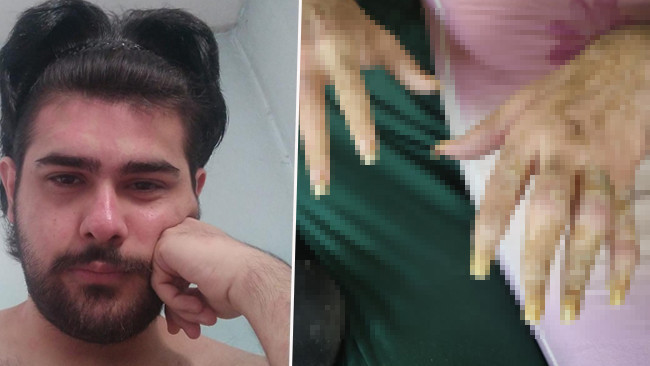 3 Yıldır Evden Çıkmayan Barış'ın Değişimi Ortaya Çıktı