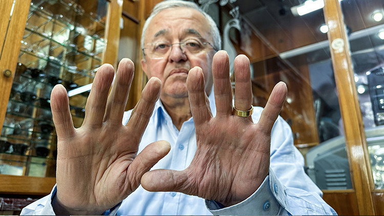 60 Yıldır Mesleğini Sürdüren Çalışanın Parmak İzleri Yok Oldu