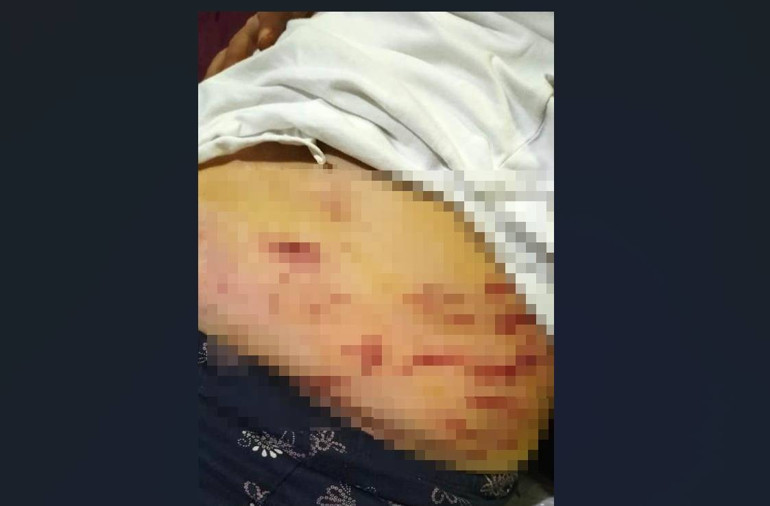 Kask Kamerasında Anlar