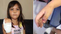 Antalya'da Anaokulunda Korkunç Olay! 4 Yaşındaki Çocuğun Parmağı, Demir Kapıya Sıkışarak Koptu