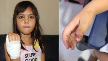 Antalya'da Anaokulunda Korkun&ccedil; Olay! 4 Yaşındaki &Ccedil;ocuğun Parmağı, Demir Kapıya Sıkışarak Koptu