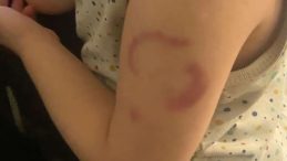 Edirne'de Kreş &Ouml;ğretmenine Y&ouml;nelik Şok Su&ccedil;lama! '&Ccedil;ocuğumu Isırdı'