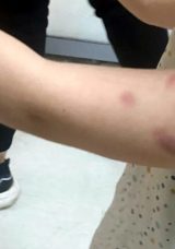 Edirne'de &Ouml;ğrencisini Isırdığı Gerek&ccedil;esiyle G&ouml;zaltına Alınan Kadın Hakkında Karar Verildi: '&Ccedil;ocuğum Travma Ge&ccedil;irdi'