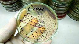 İdrar Yolu Enfeksiyonunda Ortaya Çıkan Gizli Tehlike: E. Coli Bakterisi