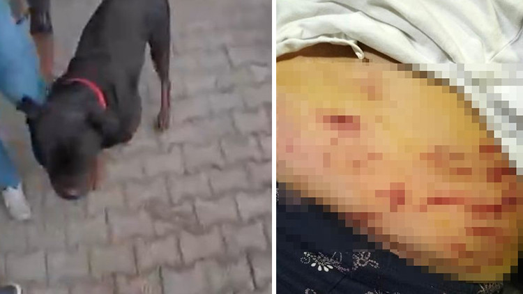 Köpeğin Ağızlığı Olmadan Dolaştırılması Sonucu Saldırı Gerçekleşti! Korku Dolu Anlar Kamerada