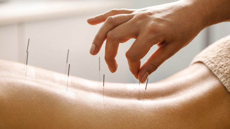 MS Hastalarına Akupunktur Tedavisi