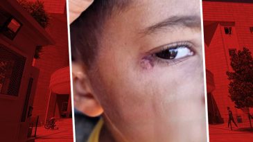 Okul Temizlik G&ouml;revlisi, 7 Yaşındaki &Ccedil;ocuğun Y&uuml;z&uuml;nde Sigara S&ouml;nd&uuml;rd&uuml;