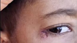 Öğrencinin Yüzünde Sigara Söndüren Temizlikçi Tutuklandı