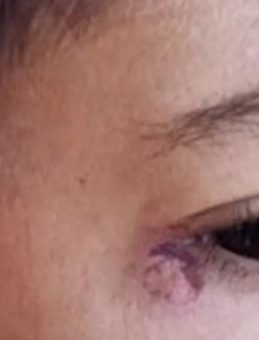 Öğrencinin Yüzünde Sigara Söndüren Temizlikçi Tutuklandı