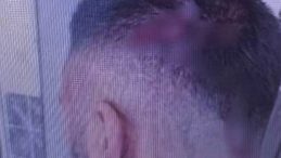 Şanlıurfa'da Öğretmene Sopayla Saldırı