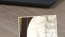 2 Yaşındaki Çocuğun Bağırsağından Toplu İğne Çıktı: 'Hayati Tehlike Yaşayabilirdi'