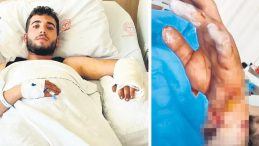 Ankara'da Köpek Saldırısı! MS Hastası Genç Ağır Yaralandı!