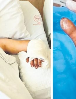 Ankara'da Köpek Saldırısı! MS Hastası Genç Ağır Yaralandı!