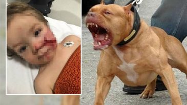 Ankara'da Pitbull Saldırısı: &Ccedil;ocuğun Y&uuml;z&uuml; Ciddi Şekilde Yaralandı