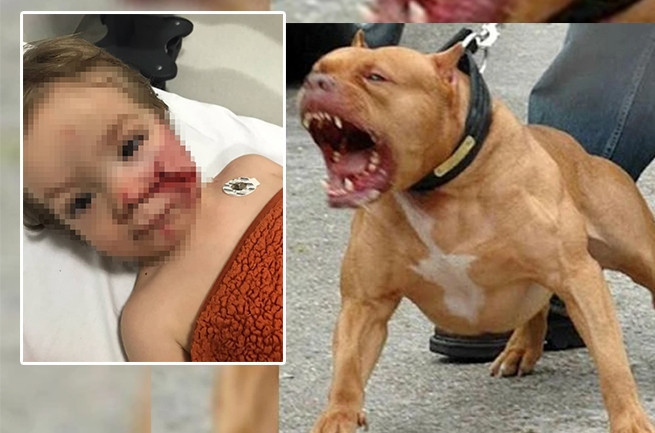 Ankara'da Pitbull Saldırısı: &Ccedil;ocuğun Y&uuml;z&uuml; Ciddi Şekilde Yaralandı