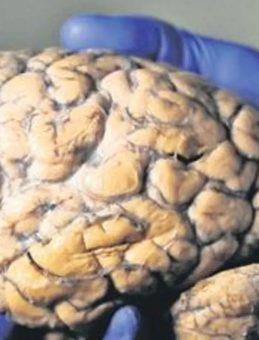 Beyin Sağlığını Korumanın 6 Yolu