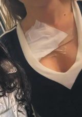 G&ouml;ğ&uuml;s Estetiği Kabusa D&ouml;nd&uuml;