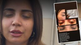 Güzellik Merkezi Facialı: Gözde Yapıştırıcı Tehlikesi