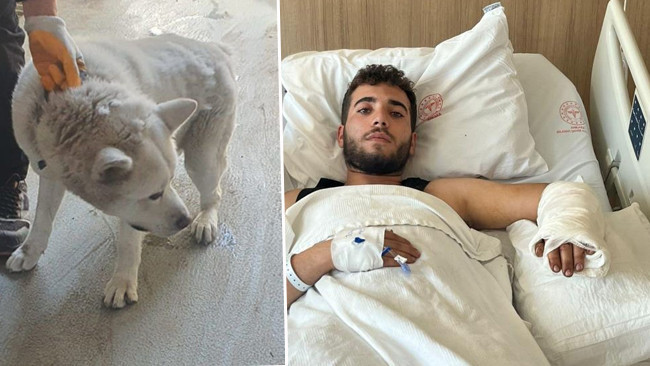 İşyerindeki Köpeğin Saldırısına Uğrayan Genç Yaşadıklarını Anlattı: 'Yemeğini Verdiğim Sırada Önce Kafamdan, Sonra Kolumdan Isırdı'