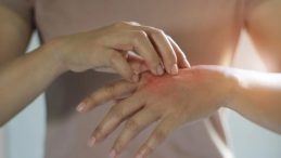 İyi geliyor sanıyorsunuz ama cildinizi yakıyor! Uzmanlar kışın en sık yapılan 3 hatayı s&ouml;yledi