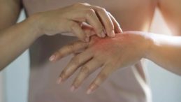 Kış Mevsiminde Dikkat Edilmesi Gereken Cilt Hataları