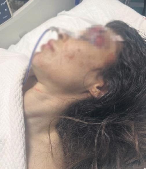 Komalık Eden Yumruğa 20 Yıl İstendi