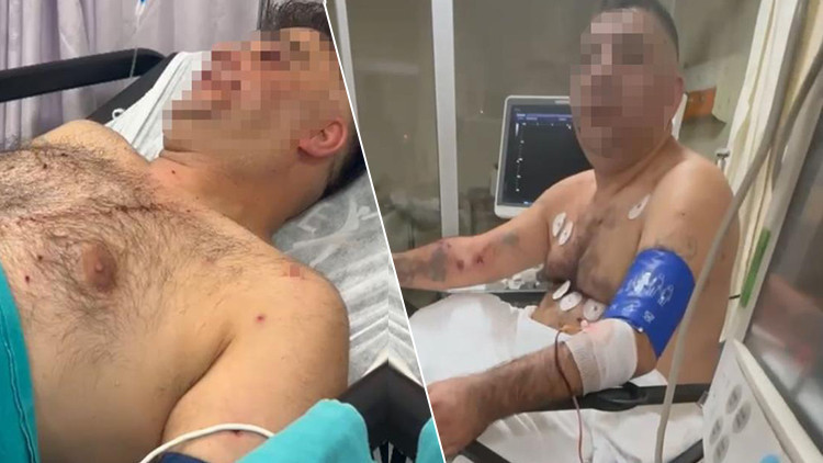 Pompalı Tüfekle Saldıran Şahıs, 1'i Polis 4 Kişiyi Yaraladı